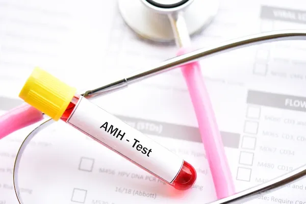 AMH Test Price in UAE: Understanding the Cost and Value of Fertility Testing | Art Fertility